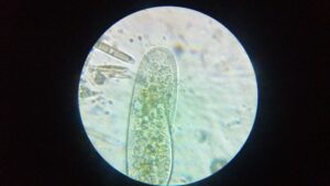 Are Protists Eukaryotic