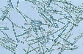 example of prokaryotic cell
