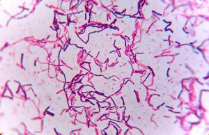 800px Gram positive bacilli