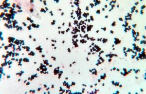 800px Gram positive cocci in clusters