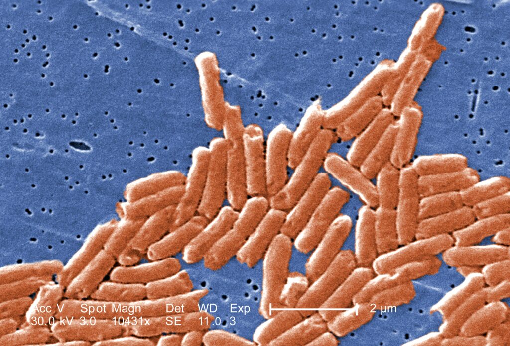 gram negative bacilli or rod shaped salmonella sp bacteria