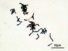 N+ Non Pathogenic Bacteria Examples :Detailed Explanations