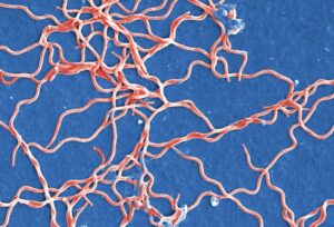 anaerobic bacteria examples