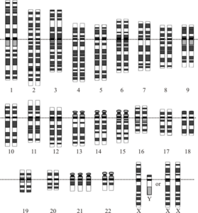 800px Down Syndrome Karyotype