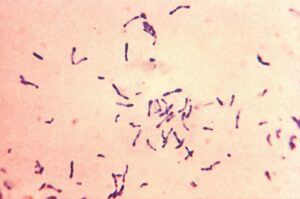 Corynebacterium diphtheriae as Non motile Bacteria Example