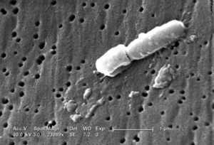 KlebSiella granulomatis as Non motile Bacteria Examples