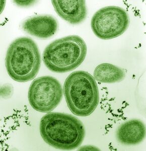 Cyanobacteria from source - Wikipedia