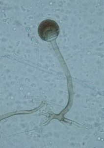 Rhizopus microsporus