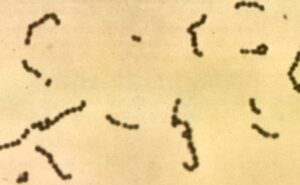  Streptococcus Enterobacter as Non motile Bacteria Example