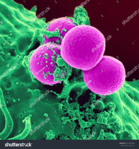 stock photo staphylococcus aureus colony 1373223506 1