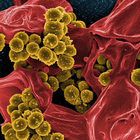 staphylococcus bacteria examples