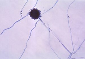 800px Aspergillus niger 01