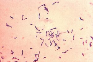 800px Corynebacterium diphtheriae Gram stain