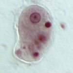 800px Entamoeba histolytica