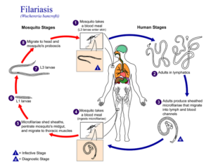 800px Filariasis 01