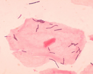 Lactobacillus sp 01