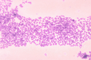 Micrococcus mucilaginosis 01