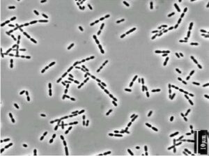 Ruminococcus photo