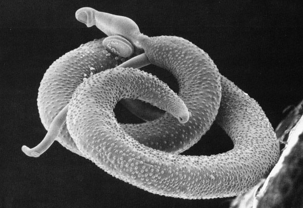 Schistosoma mansoni2