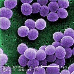 staphylococcus bacteria examples