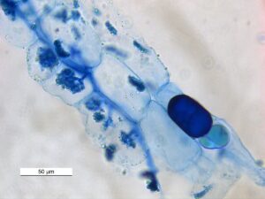 Vesicular Arbuscular Mycorrhizae 40X0031 03