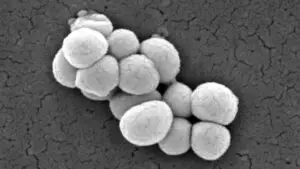 1200px Micrococcus luteus 9759 edited 300x169 1