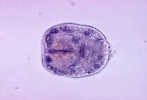 800px Echinococcus granulosus scolex 300x204 1