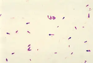 photomicrograph of clostridium botulinum type a viewed using a gram stain technique 550x374 1 300x204 1