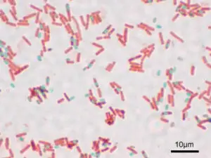 Bacillus subtilis Spore 300x225 1